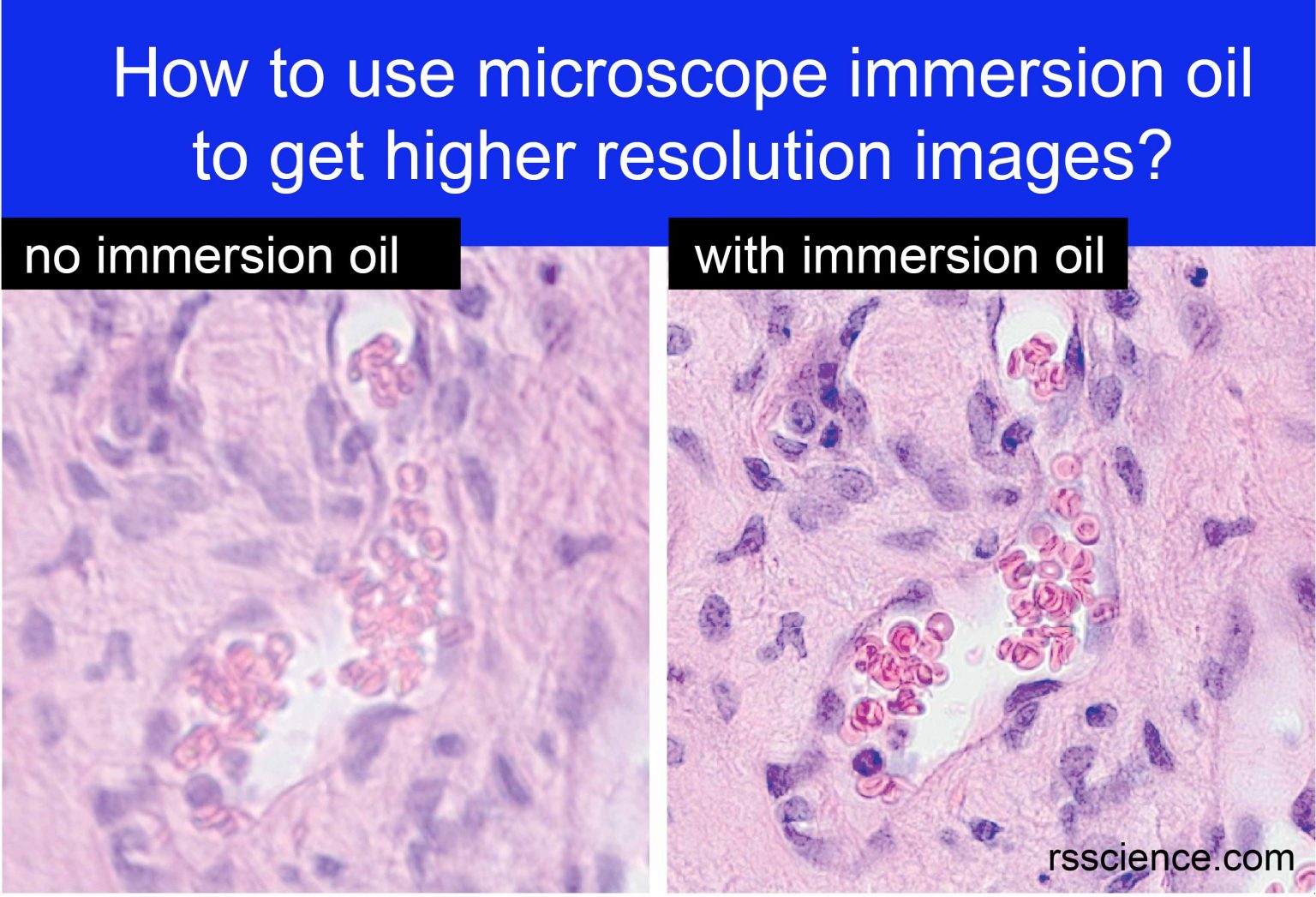 13 Tips You Should Know about Taking Care of Your Microscope Rs' Science