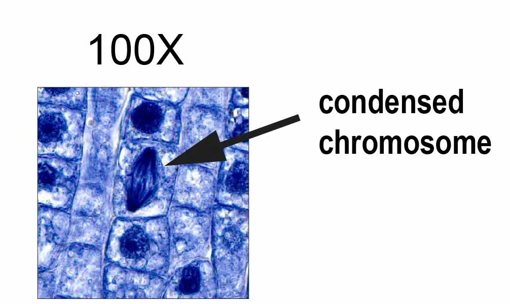 100x condensed chromosome dividing