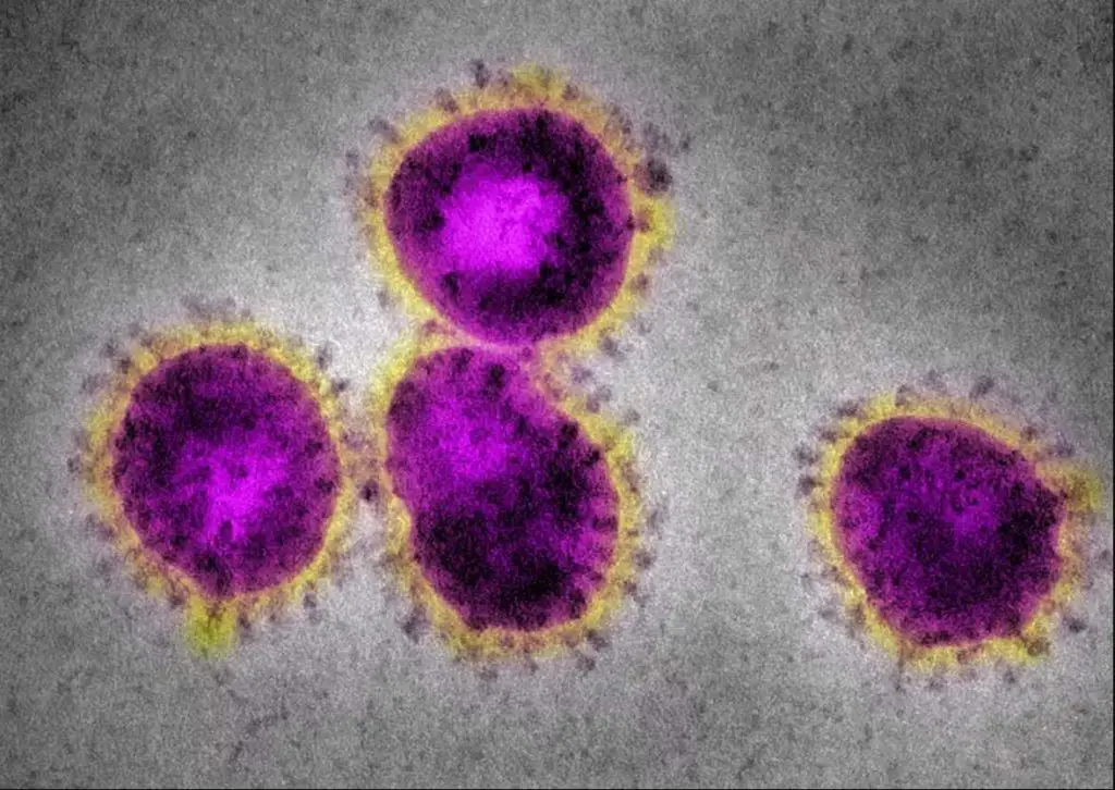 Electron micrographs Coronaviruses color