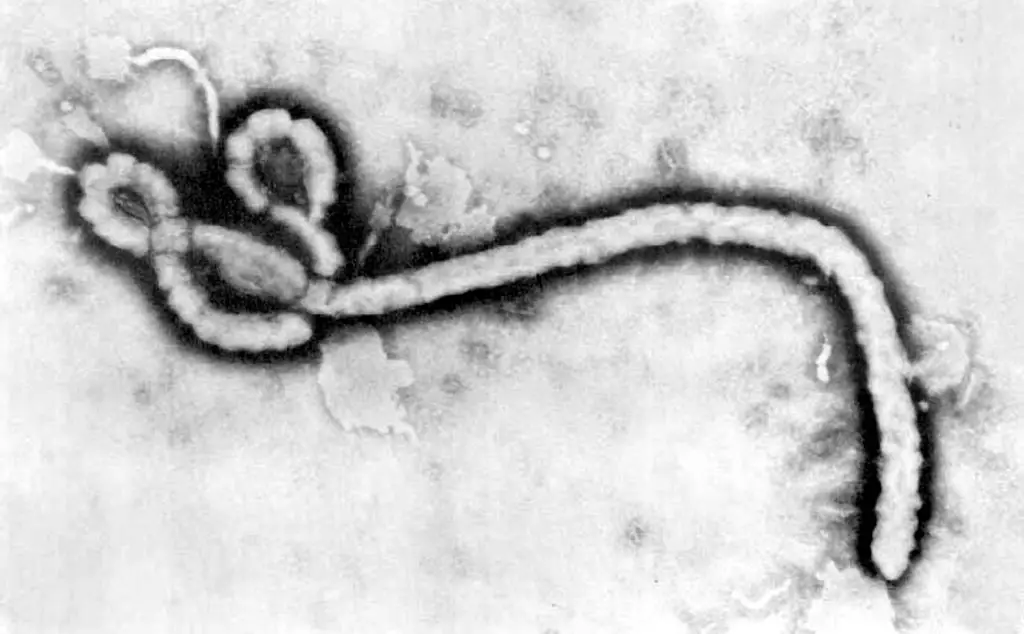 Electron micrographs Ebola virus