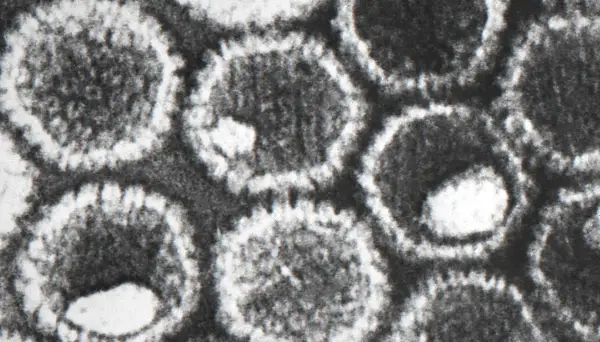 Electron micrographs Herpes simplex virus CDC