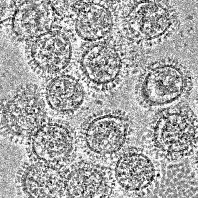 Electron micrographs influenza virus
