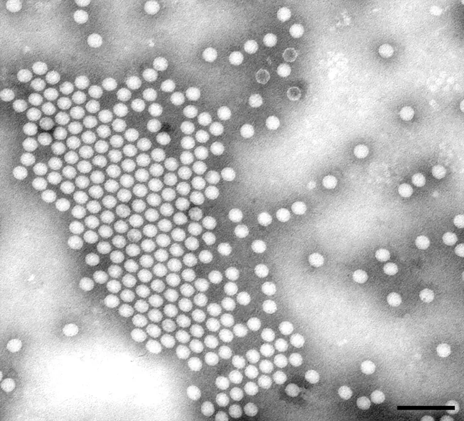 Electron micrographs poliovirus