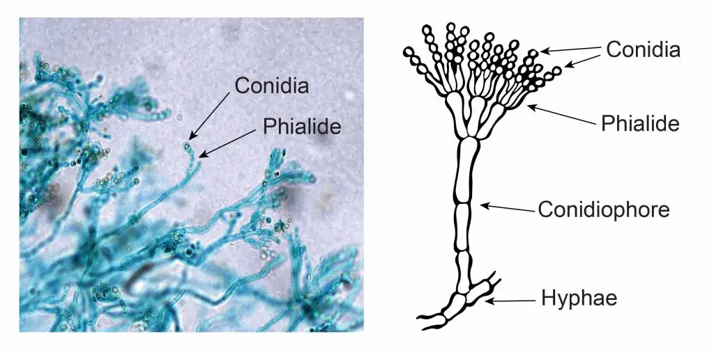 Penicillium microscopic view