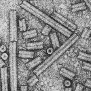Tobacco-Rattles-Virus-Electron-Microscope