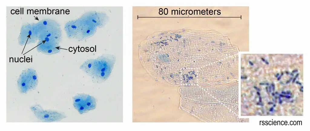 cheek-cells-methylene-blue