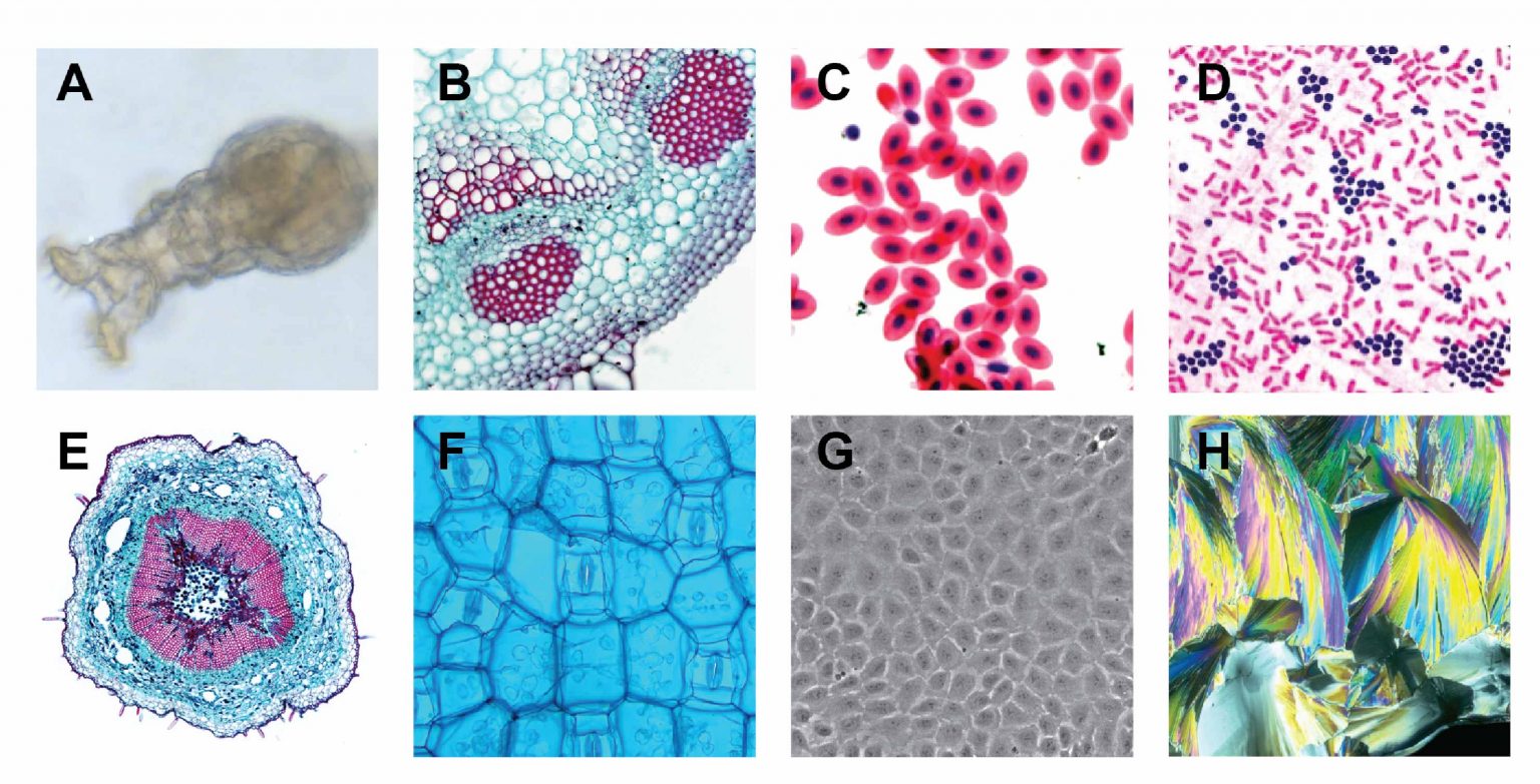 Different types of Microscopes light microscope, electron microscope