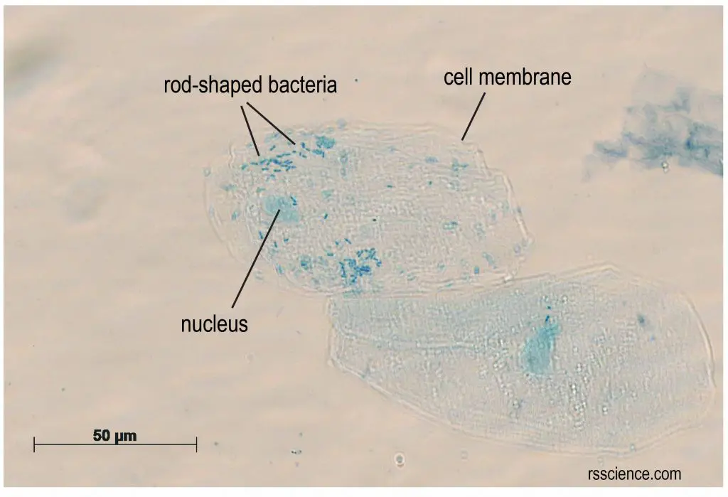 human_cheek_cells_bacteria methylene blue stain