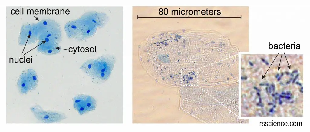 Cheek-cells-with-bacteria