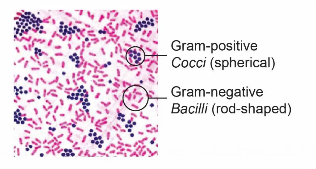 gram stain gram positive and negative bacteria