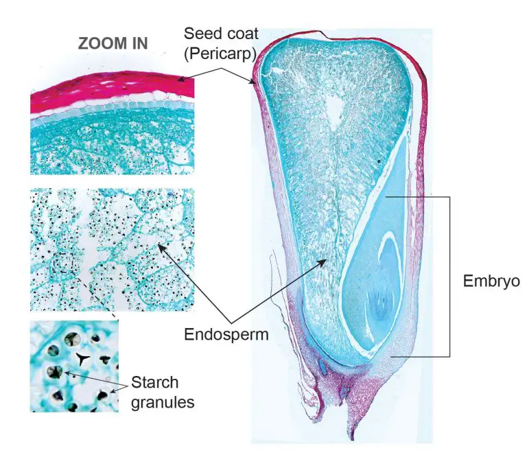 Plant tissue under a microscope xylem and phloem Rs' Science