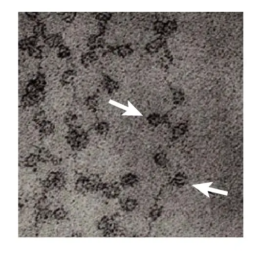 nucleosomes_electron micrograph