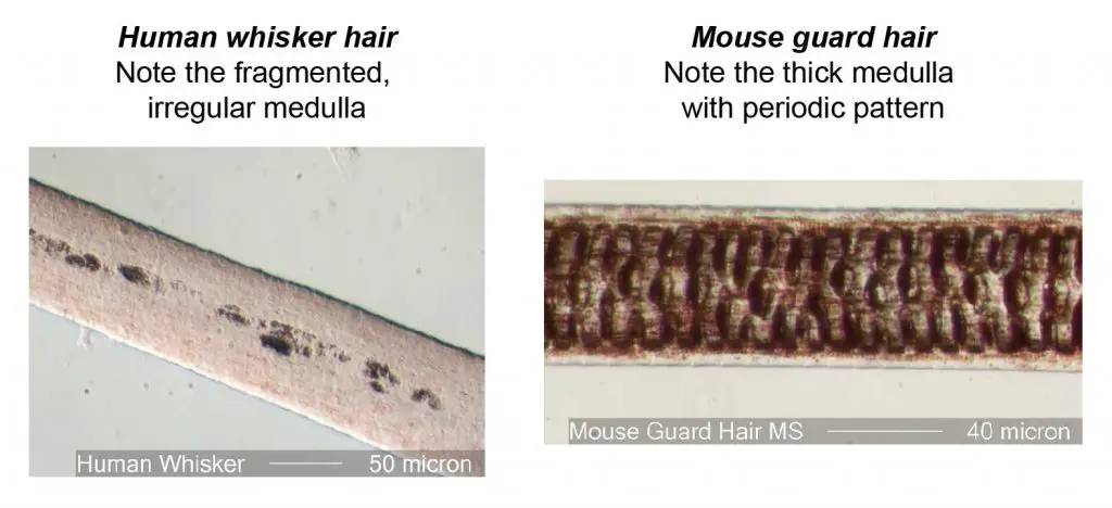 human hair under microscope medulla