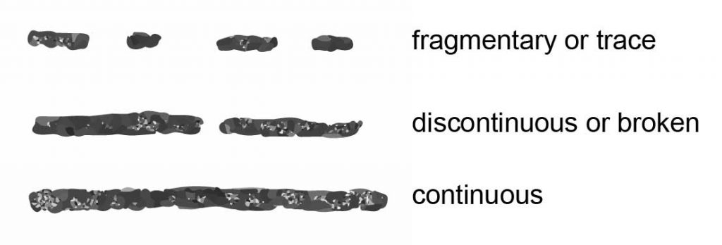 Three-Basic-Medullary-Types