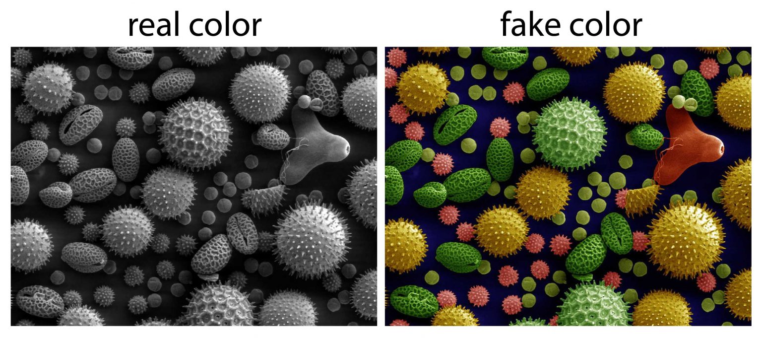 5 Science Facts Behind Astonishing Electron Microscope Images - Rs' Science