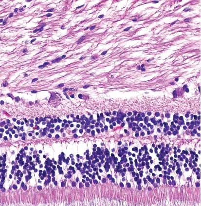 Retina-stained-with-hematoxylin-and-eosin