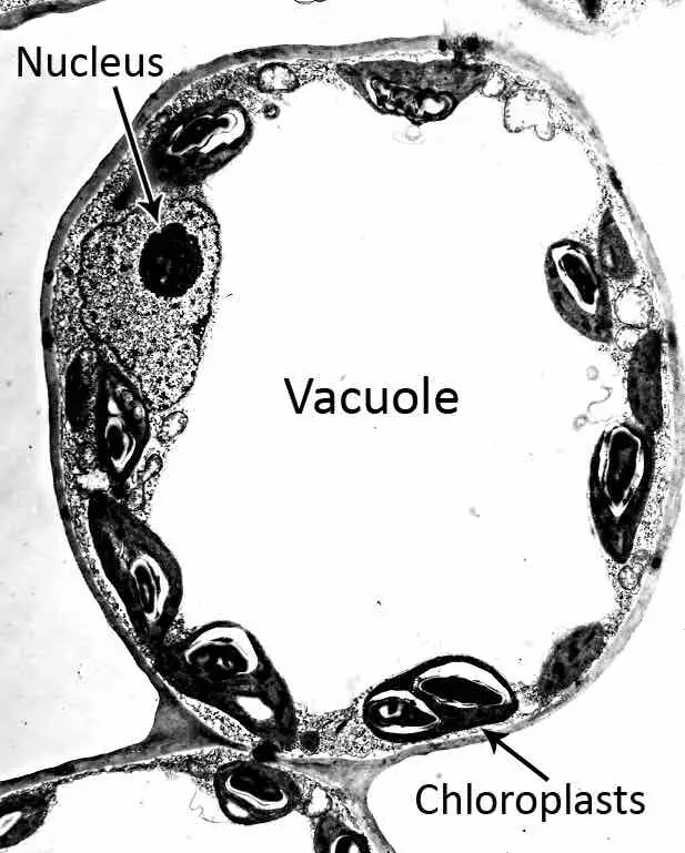 electron-micrography-of-Vacuole