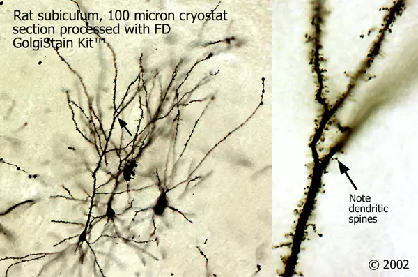 Golgi-staining neuron