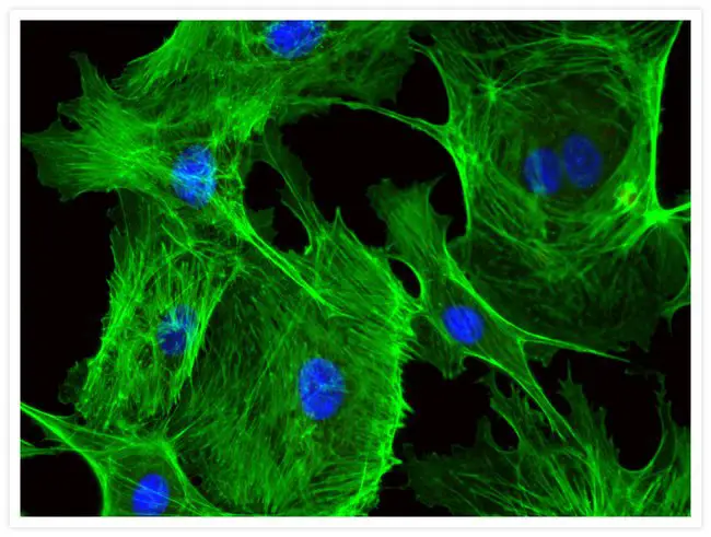endothelial cells stained with fluorescent dye