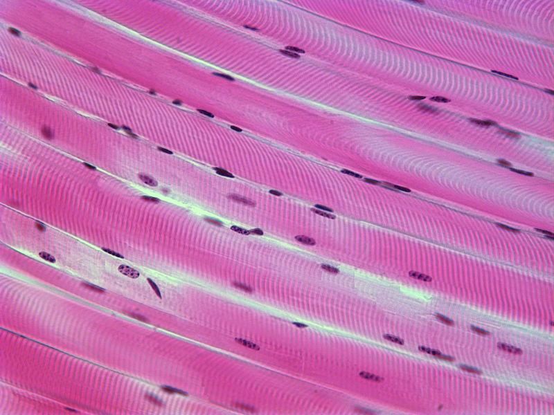 skeletal-muscle-with-multiple-nuclei