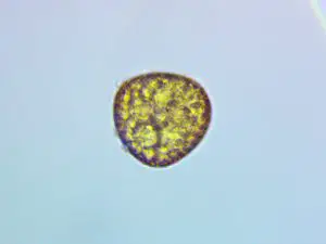 Fern Spores Under a Microscope - Rs' Science