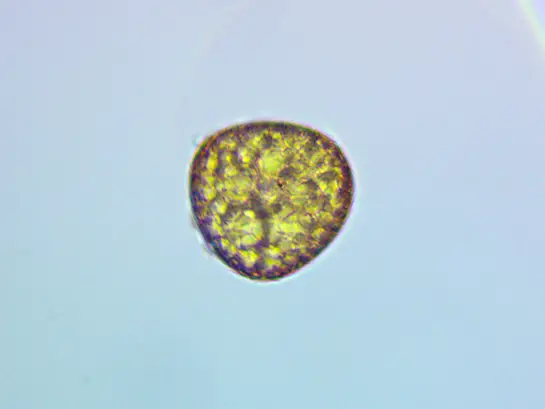 400x_fern_spore_microscope