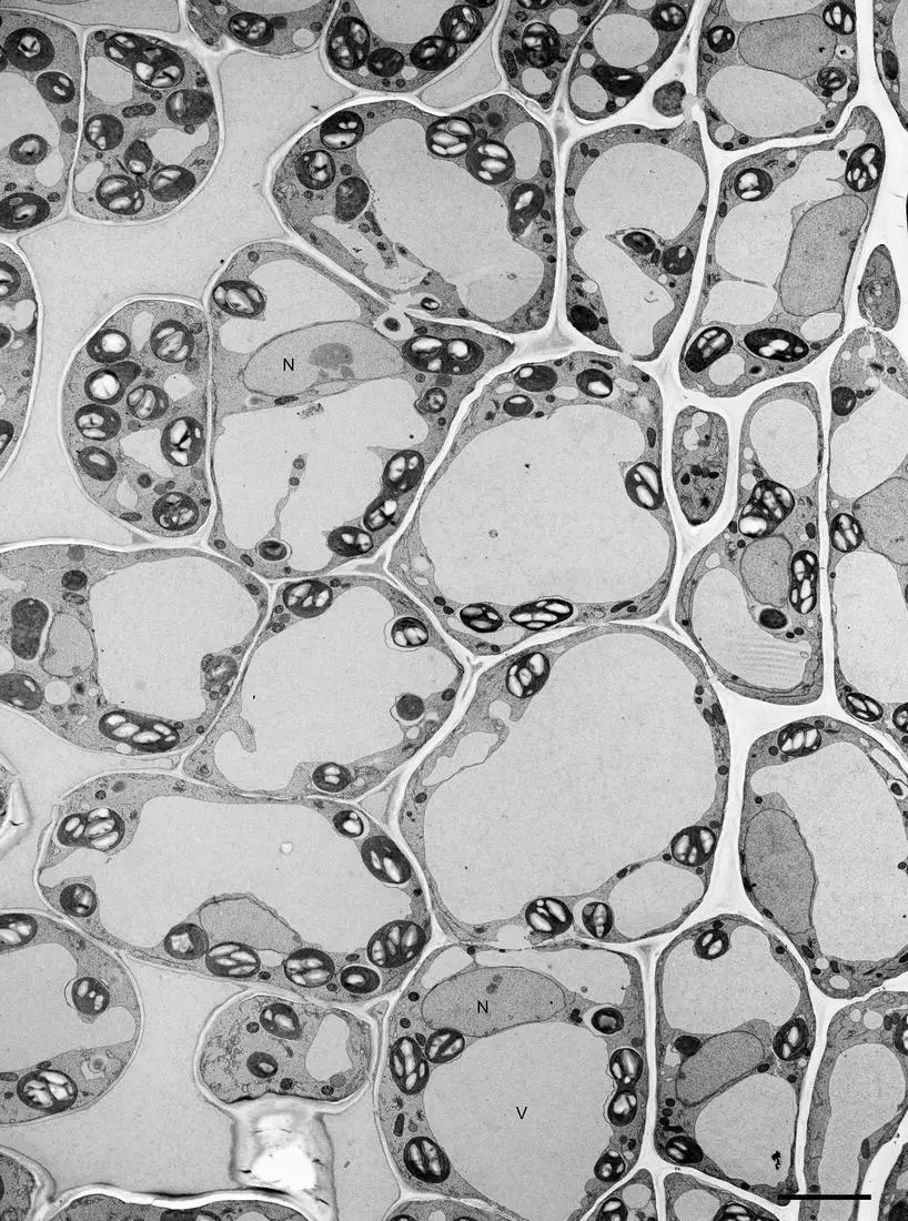 Vacuole Function and Structure - Extra Space Storage - Rs' Science