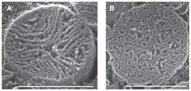 Densely-packed-cristae-in-cardiac-ventricular-myocytes-Scanning-EM-images