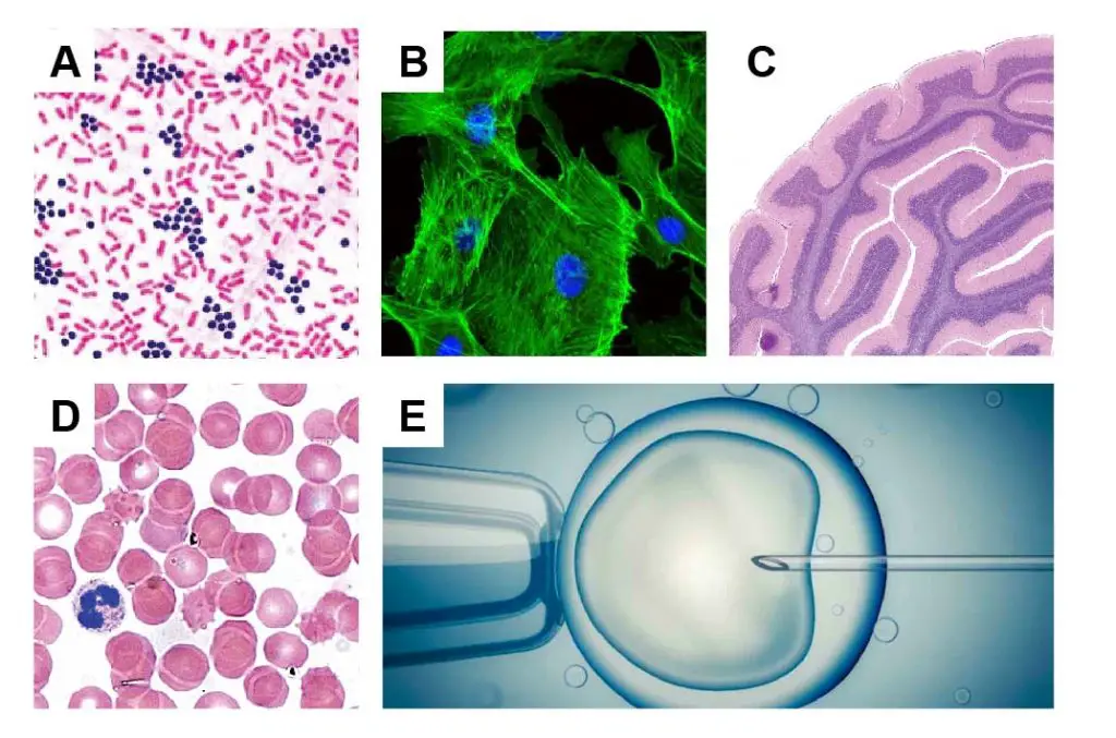 bacteria-microinjection-ivf-histology