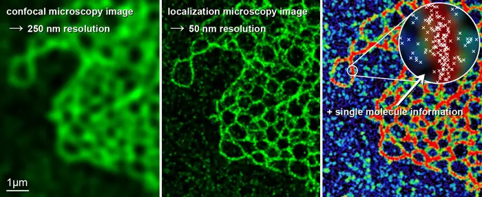 images-from-confocal-vs-super-resolution-microscope