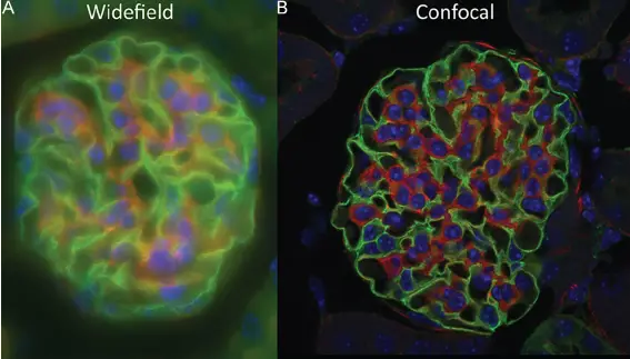 images-from-widefield-vs-confocal