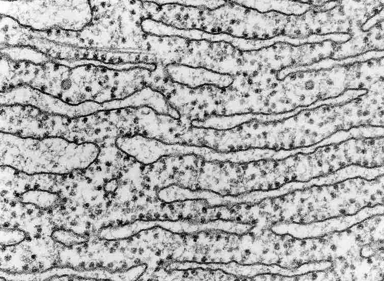 ribosome-TEM