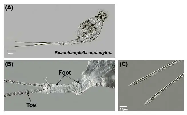 Monogononat-rotifer-foot-and-toes