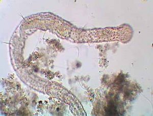 Microscopic Organisms In A Drop Of Pond Water