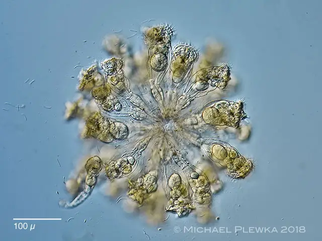 Rotifer_colony