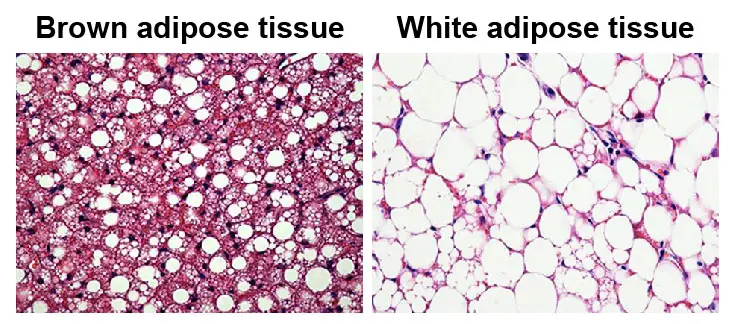 brown-adipose-and-white-adipose-tissue