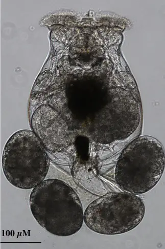 female-rotifer-4-eggs