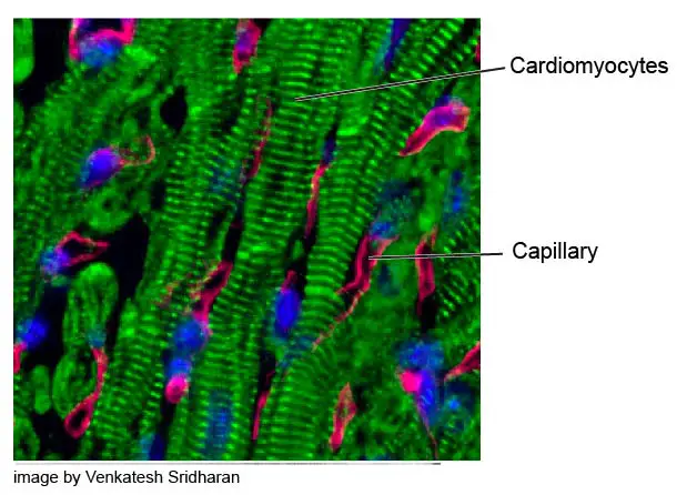 highly-vascularized-heart-muscle