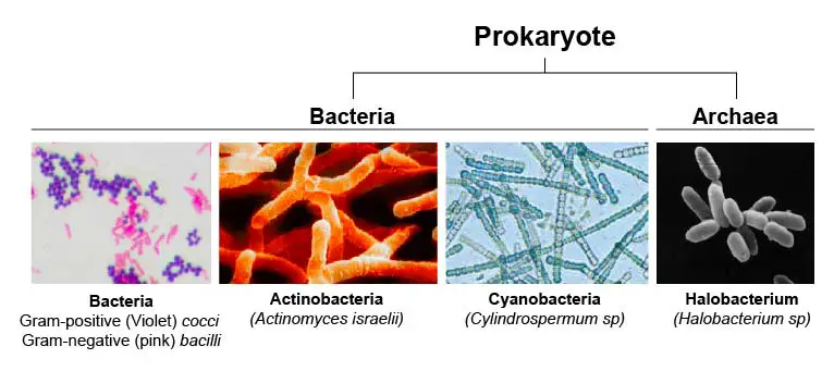 prokaryote-bacteria-actinobacteria-cyanobacteria-halobacterium