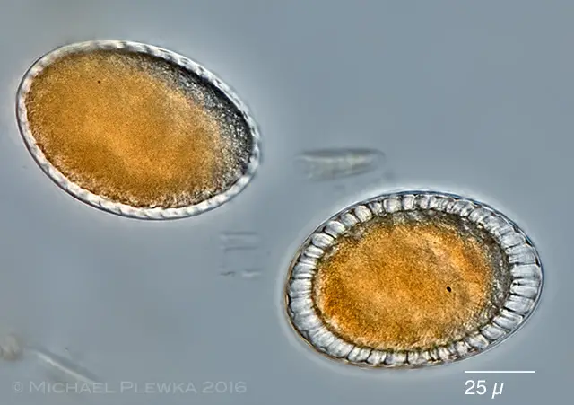 rotifer_resting_egg