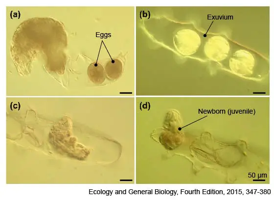 tardigrade-female-egg-exuvium