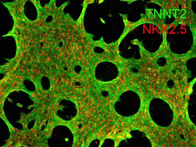 Immunofluorescent staining of human iPSC-derived cardiomyocytes 