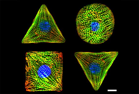 cardiomyocyte-pattern