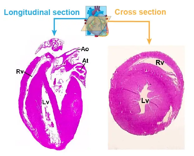 cross-section-longitudinal-section-heart