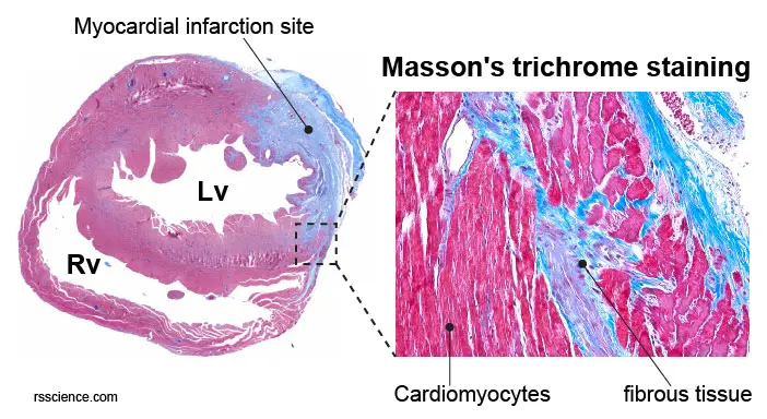 mouse-heart-Massons-trichrome-staining