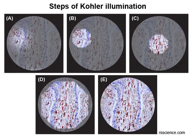 steps-Kohler-illumination