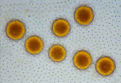 volvox-cell-fertilized-egg-cells
