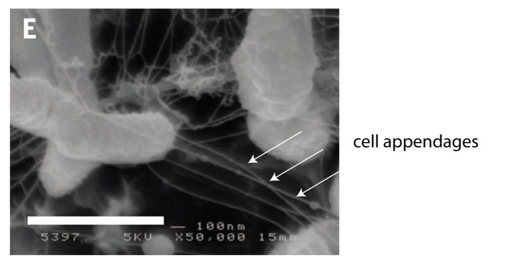 SEM-image-Ideonella-sakaiensis