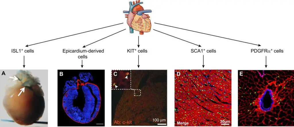 different-stem-cell-populations-in-heart