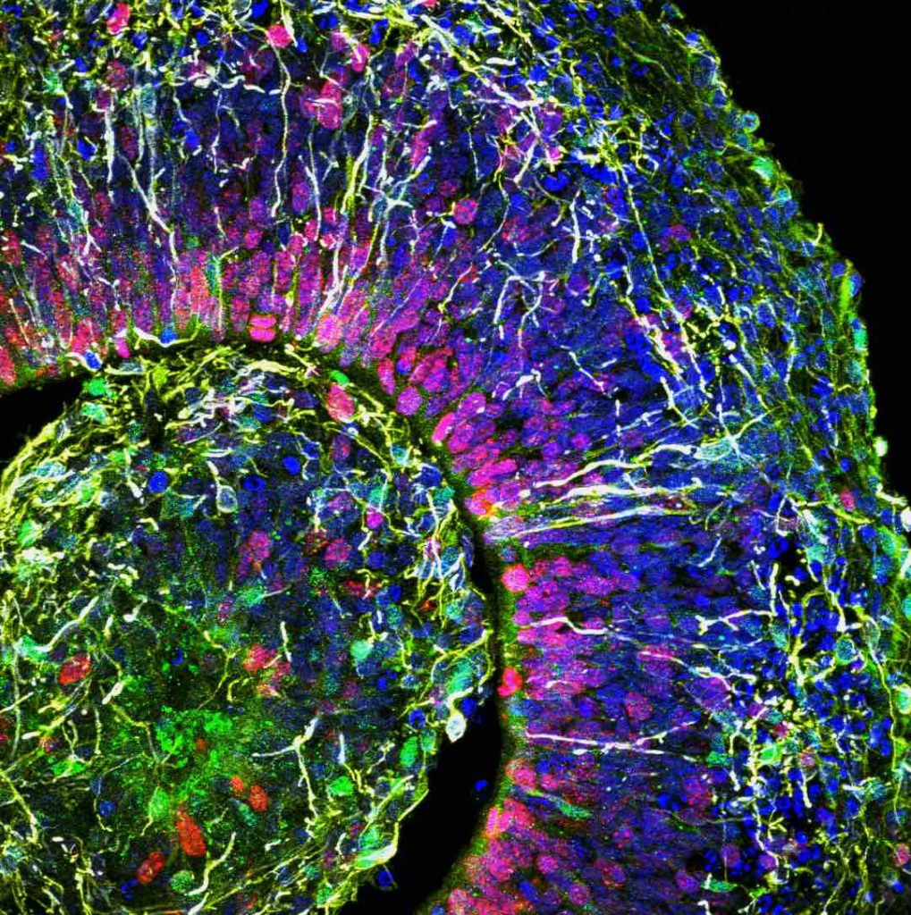 Brain-organoid